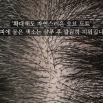 두피엔도트 | 남는 도트가 모두 다르기 때문에 고객님 피부타입, 모발 굵기,... | Instagram Instagram의 🇰🇷오브스튜디오 | 대구두피문신 대구눈썹문신...