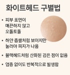 하얀 여드름, 짜면 안 되는 이유 화이트헤드 구별법과 관리법 - 건강을 위한 발걸음