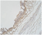 석영카데코 | Local Defence System in Healthy Lungs
