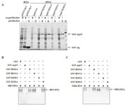 Porcine Epidemic Diarrhea Virus nsp15 Antagonizes Interferon Signaling by RNA Degradation of TBK1 and IRF3