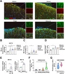 포이애(4eae) | MCT4 expression is upregulated in astrocytes of EAE mice. (A)..... MCT4 expression is upregulated in astrocytes of EAE mice. (A)...