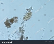 (주)에치와이 구산점S.P | 13개의 Echinostoma spp 로열티 프리 이미지 및 스톡 사진 | Shutterstock