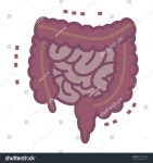 병든 소장 스톡 벡터(로열티 프리) 647280388 | Shutterstock