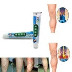 의료 정맥류 다리 산 빌지 가려움증 중국 의학 치료 크림 | 의학, 다리, 크림